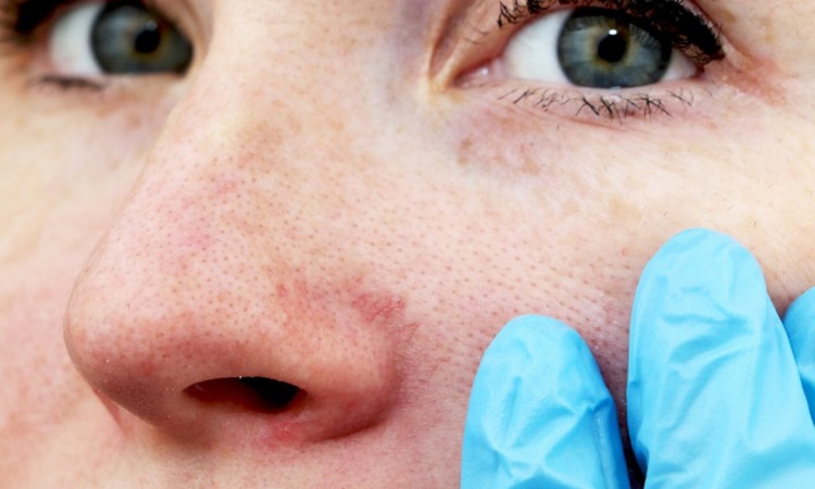 Obagi Skin Care Tupelo, Mississippi